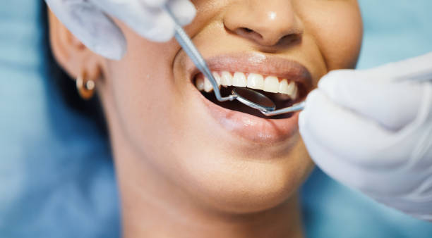 Best 24-Hour Emergency Dental Care in New City, NY