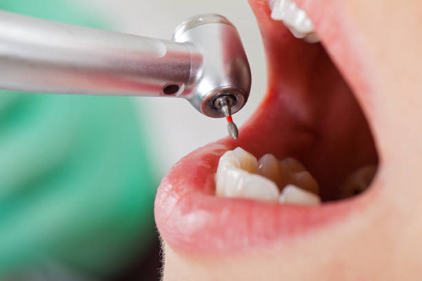 Best Emergency Orthodontic Repairs in New City, NY